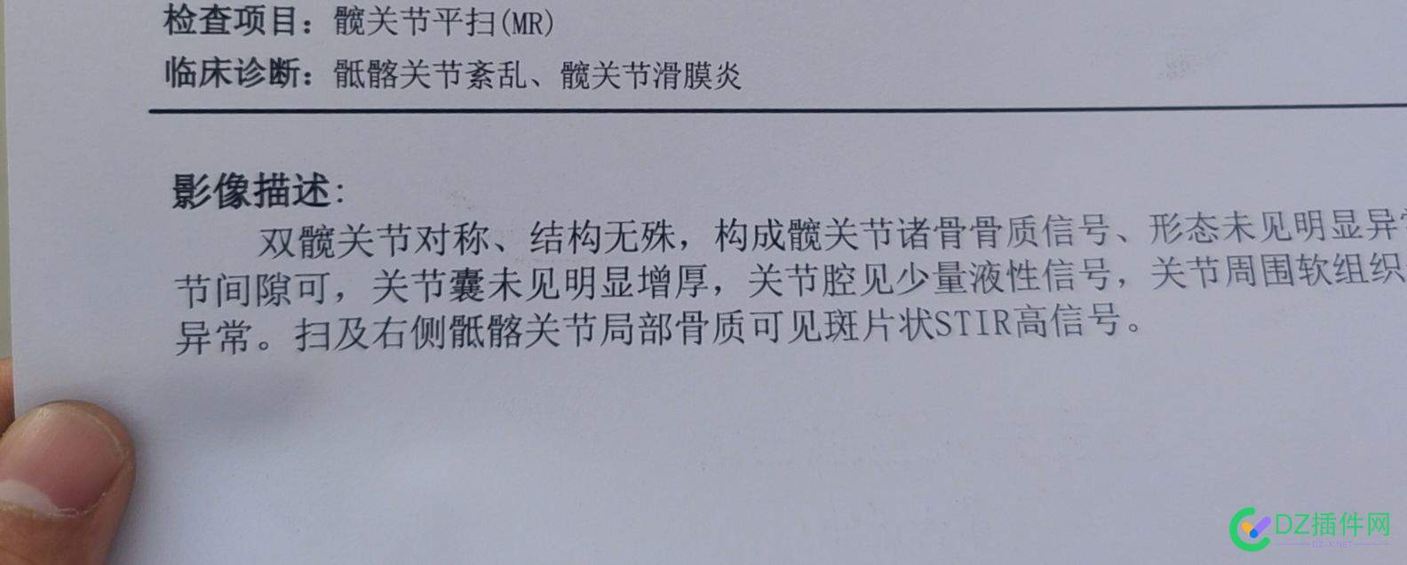 接了几单身体垮了 