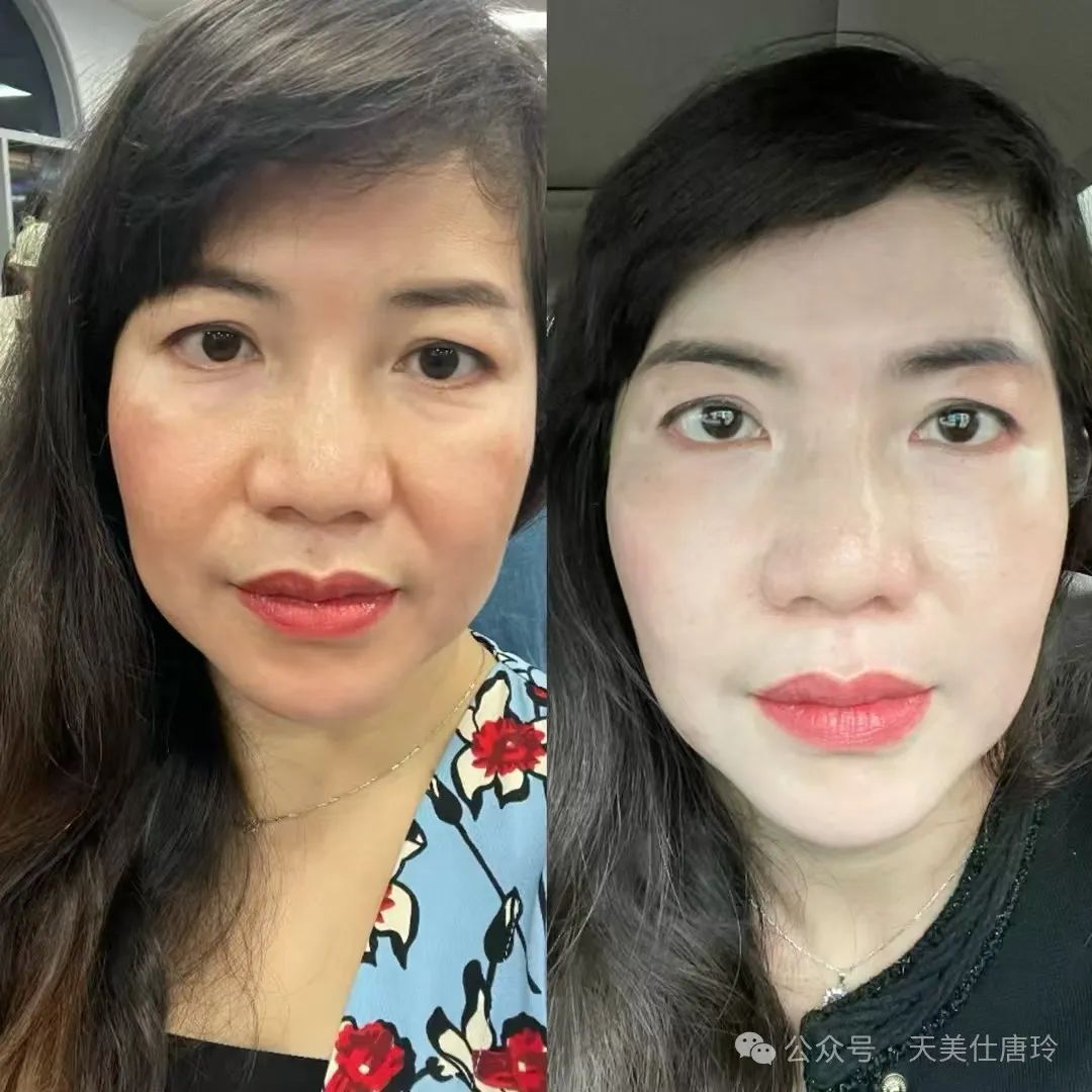 天美仕AKG全科健康管理:开启往后余生的美丽密码!2766 作者: 来源: 发布时间:2025-2-10 10:10